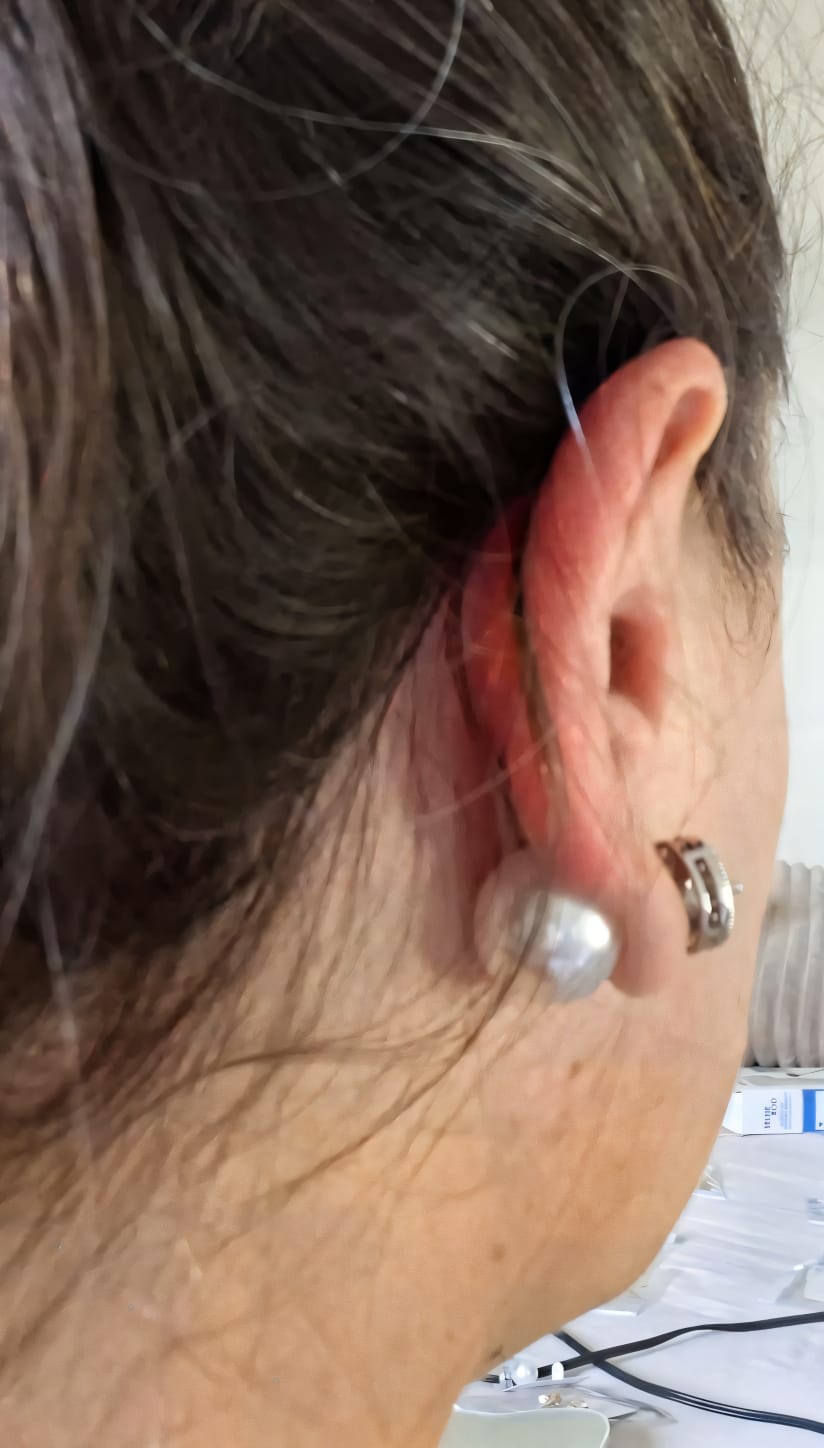 BRINCO BELLE PÉROLA